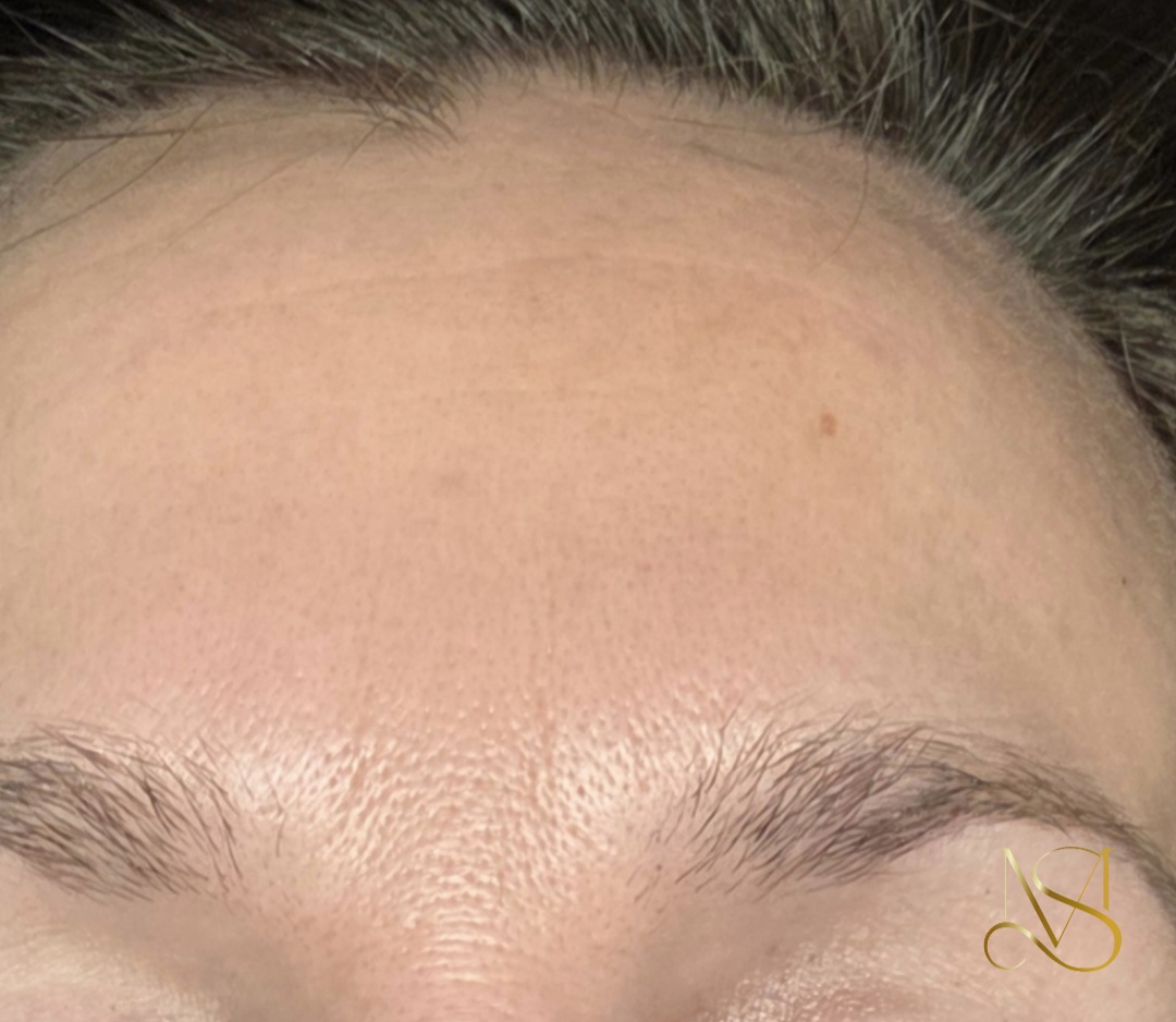 Signature Glow behandeling bij SKIN MISSON in Eindhoven.