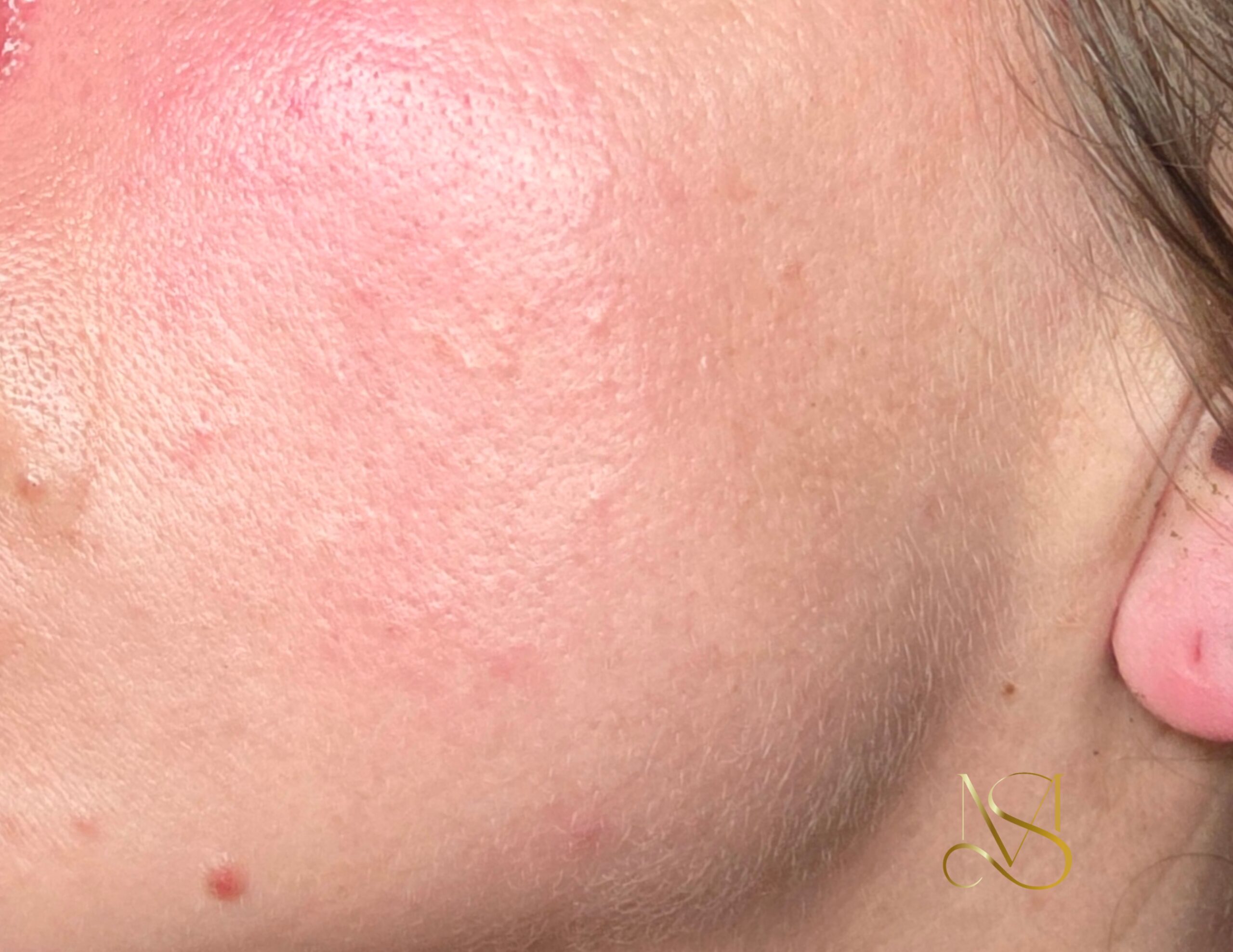 Signature Glow behandeling bij SKIN MISSON in Eindhoven.