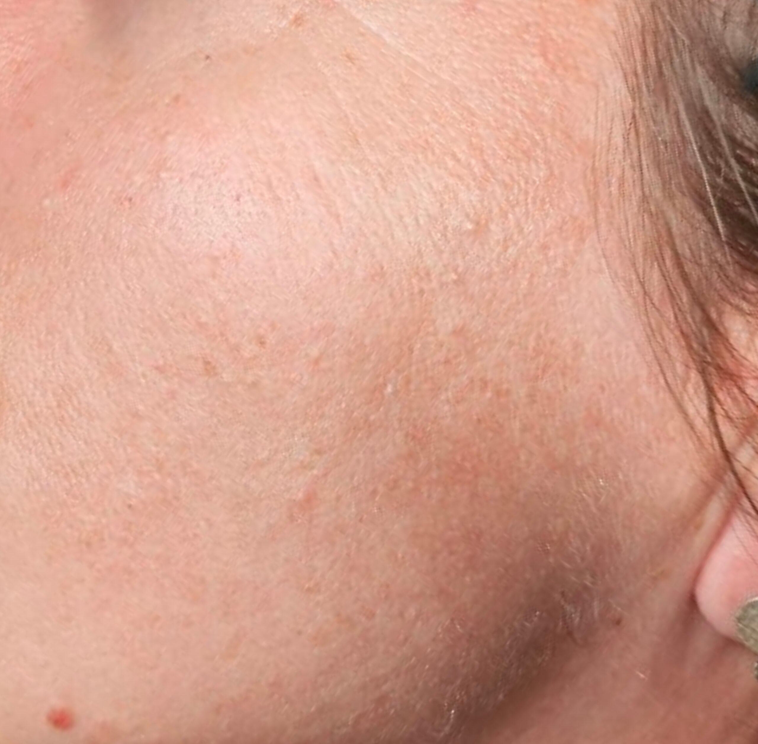 Signature Glow behandeling bij SKIN MISSON in Eindhoven.