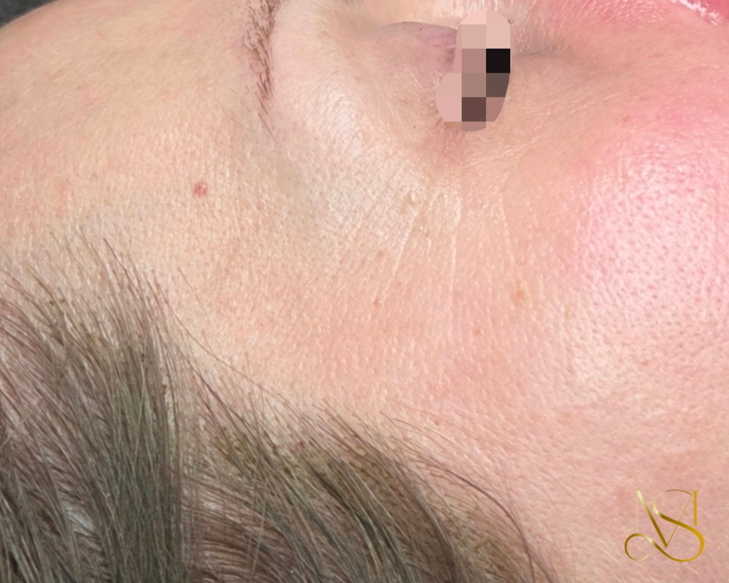 Signature Glow behandeling bij SKIN MISSON in Eindhoven.