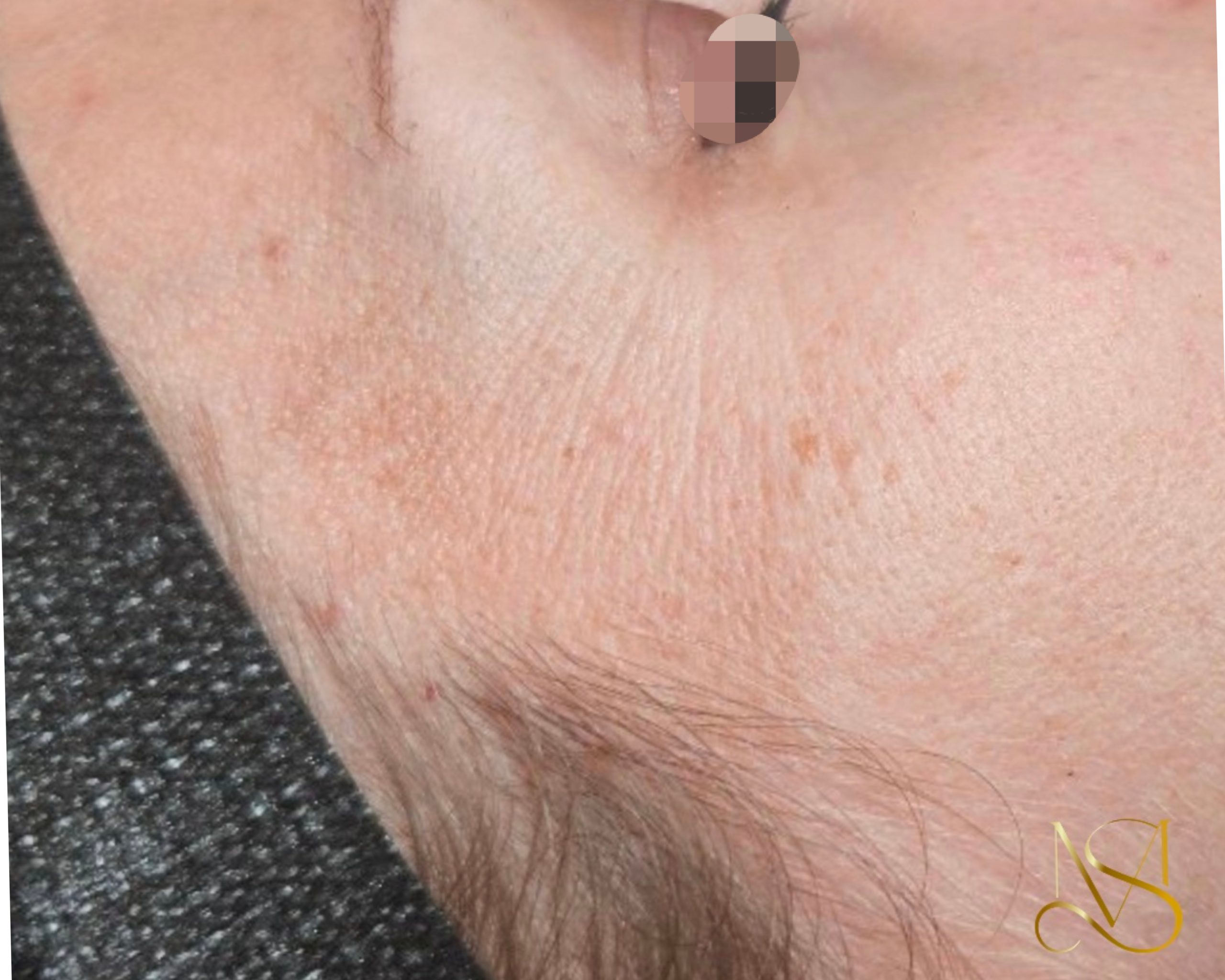 Signature Glow behandeling bij SKIN MISSON in Eindhoven.