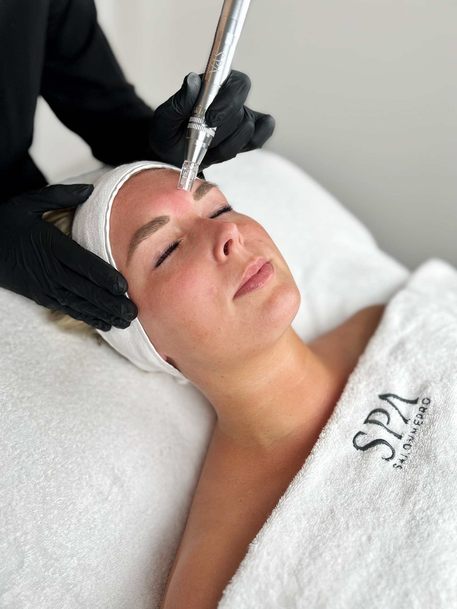 Microneedling behandeling bij SKIN MISSON in Eindhoven.