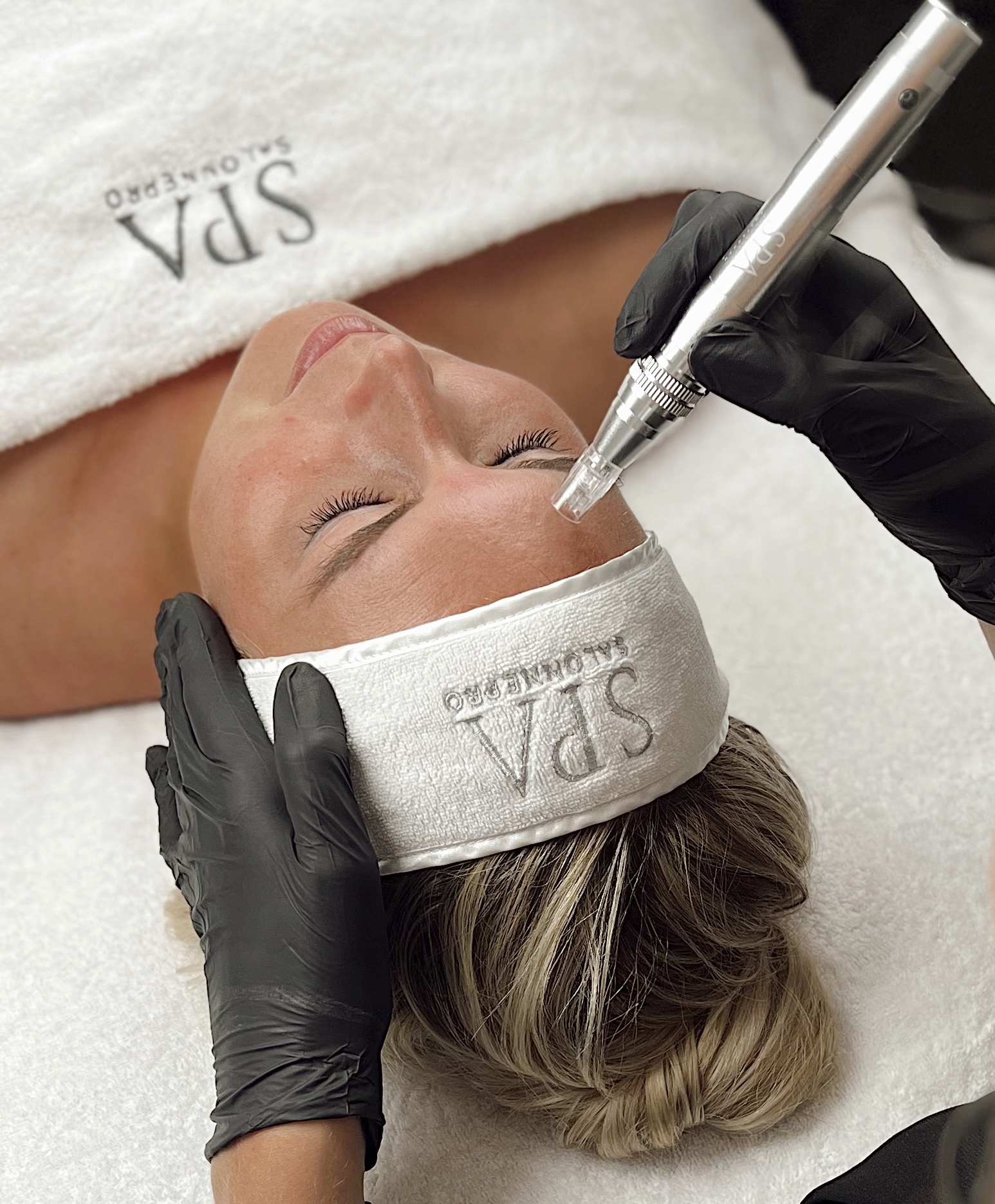 Microneedling behandeling bij SKIN MISSON in Eindhoven.