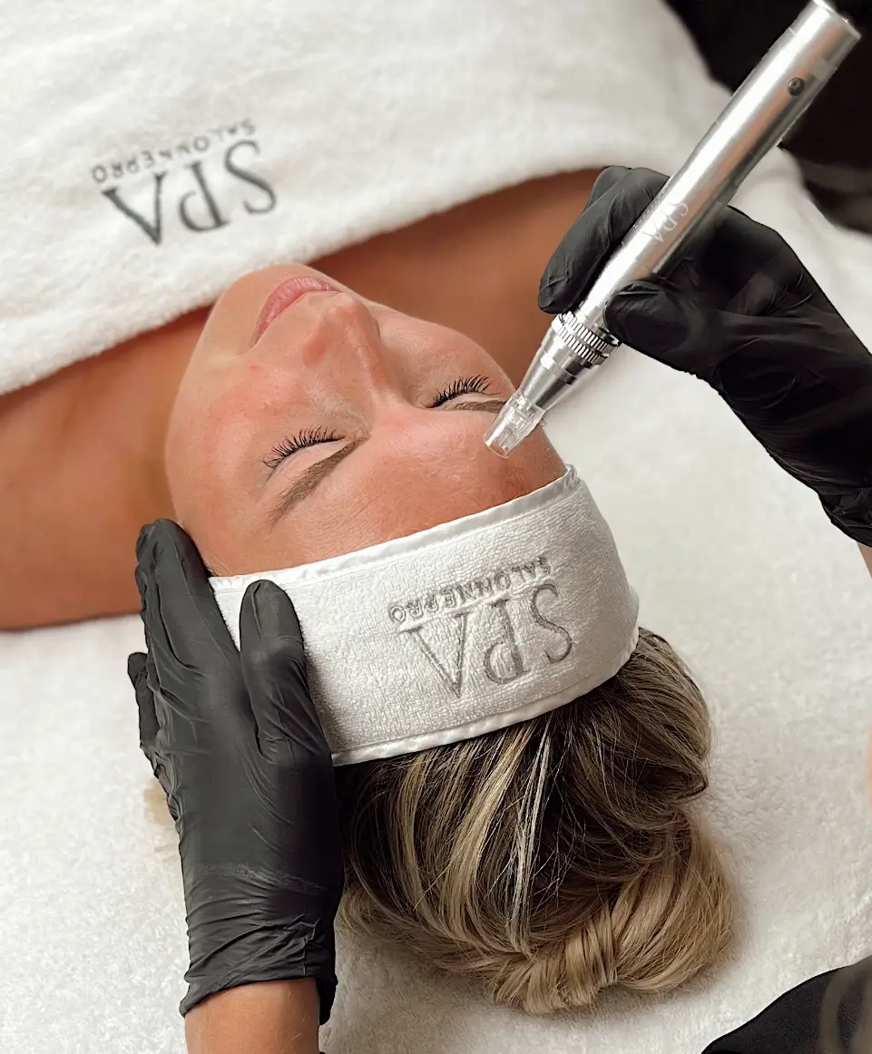 Microneedling behandeling bij SKIN MISSON in Eindhoven.