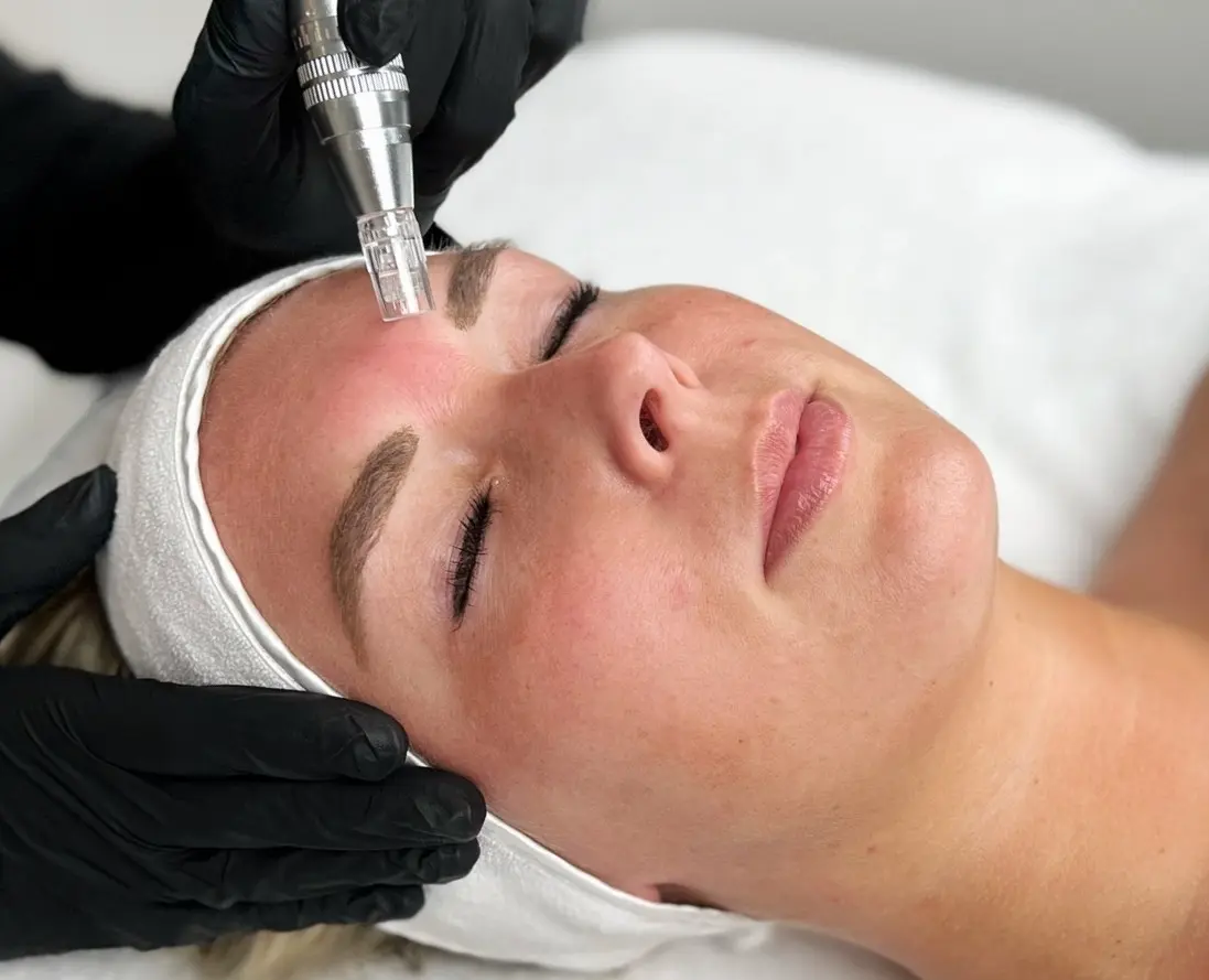 Natural Face Lift bij SKIN MISSION in Eindhoven